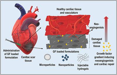 De novo Drug Delivery Modalities for Treating Damaged Hearts: Current Challenges and Emerging Solutions